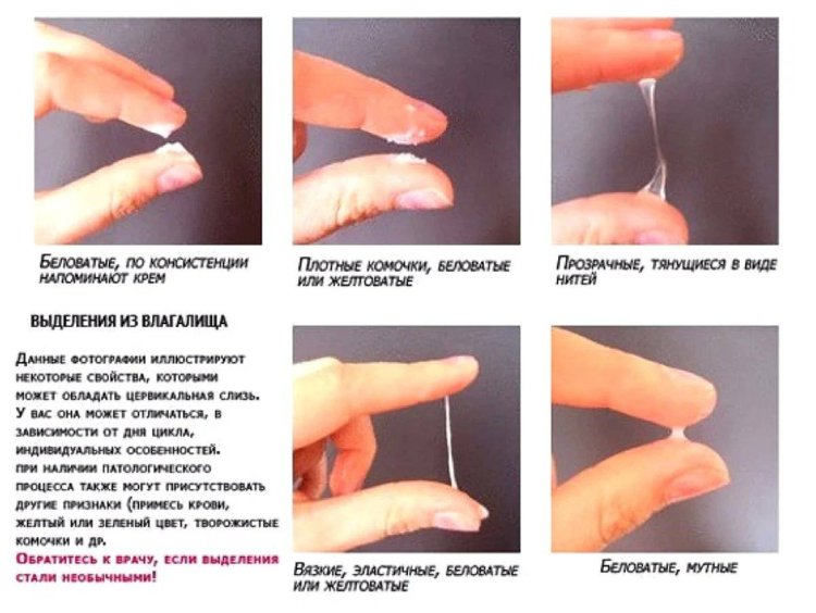 White clear mucus from the vagina