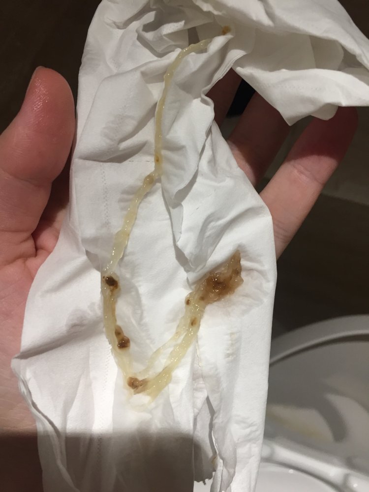 Brown discharge with mucus