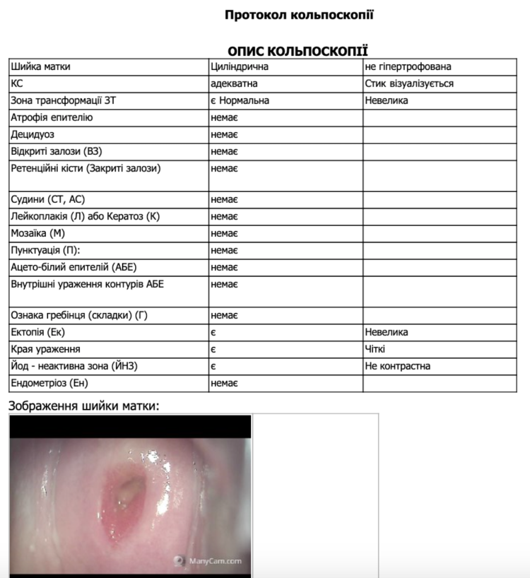 Human papillomavirus analysis