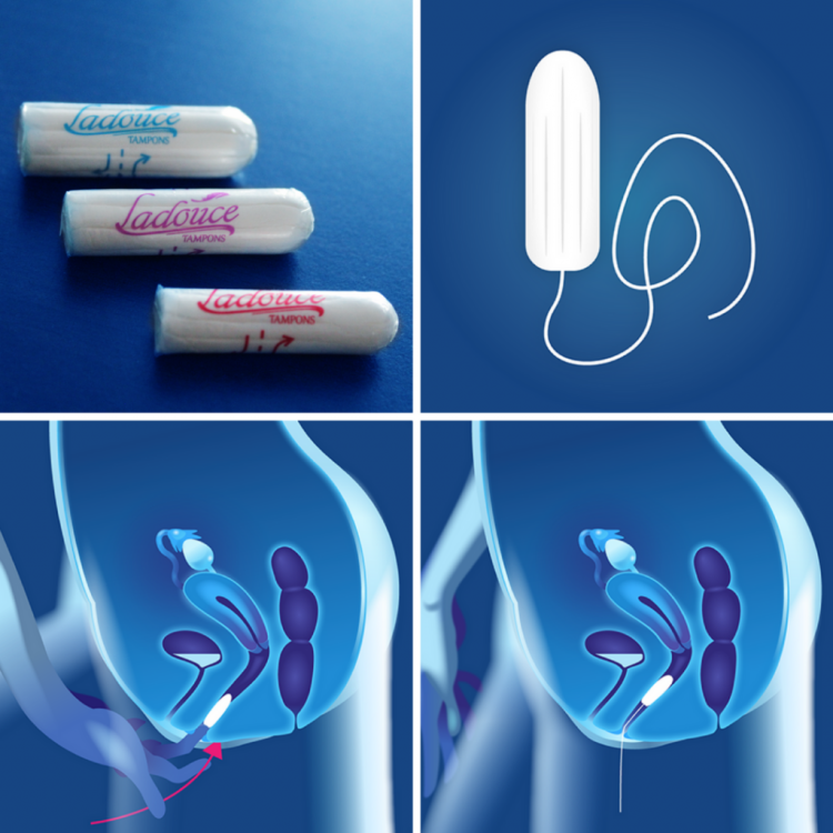 Special tampons for menstruation