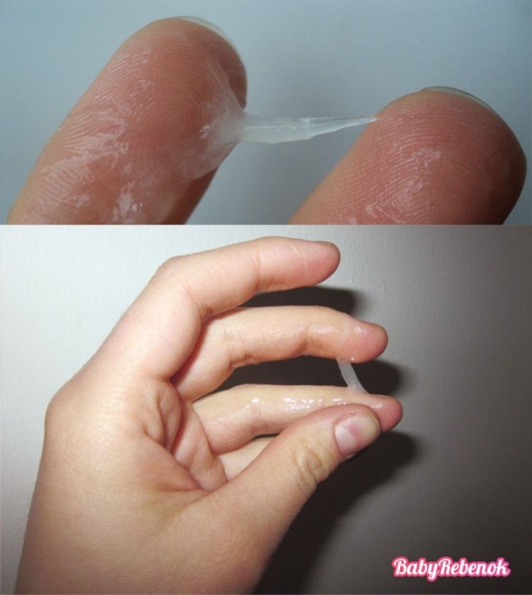 Thick translucent discharge