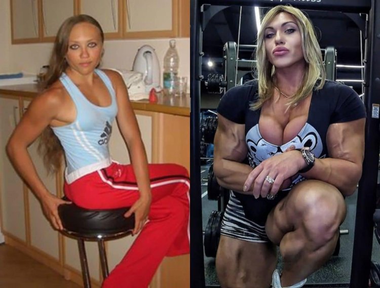 Natalya Trukhina Kuznetsova before and after