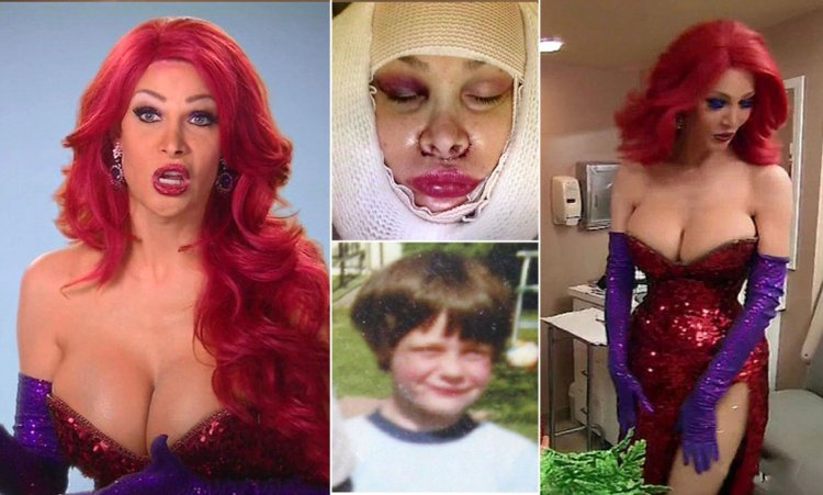 Jessica Rabbit plastic surgery