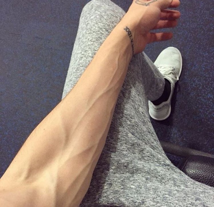 Women's vein weakness in the arms