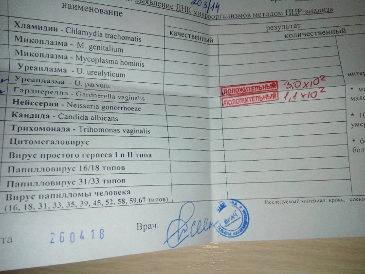 Analysis for chlamydia and ureaplasma