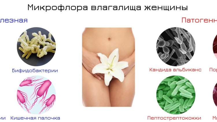 Vaginal microflora