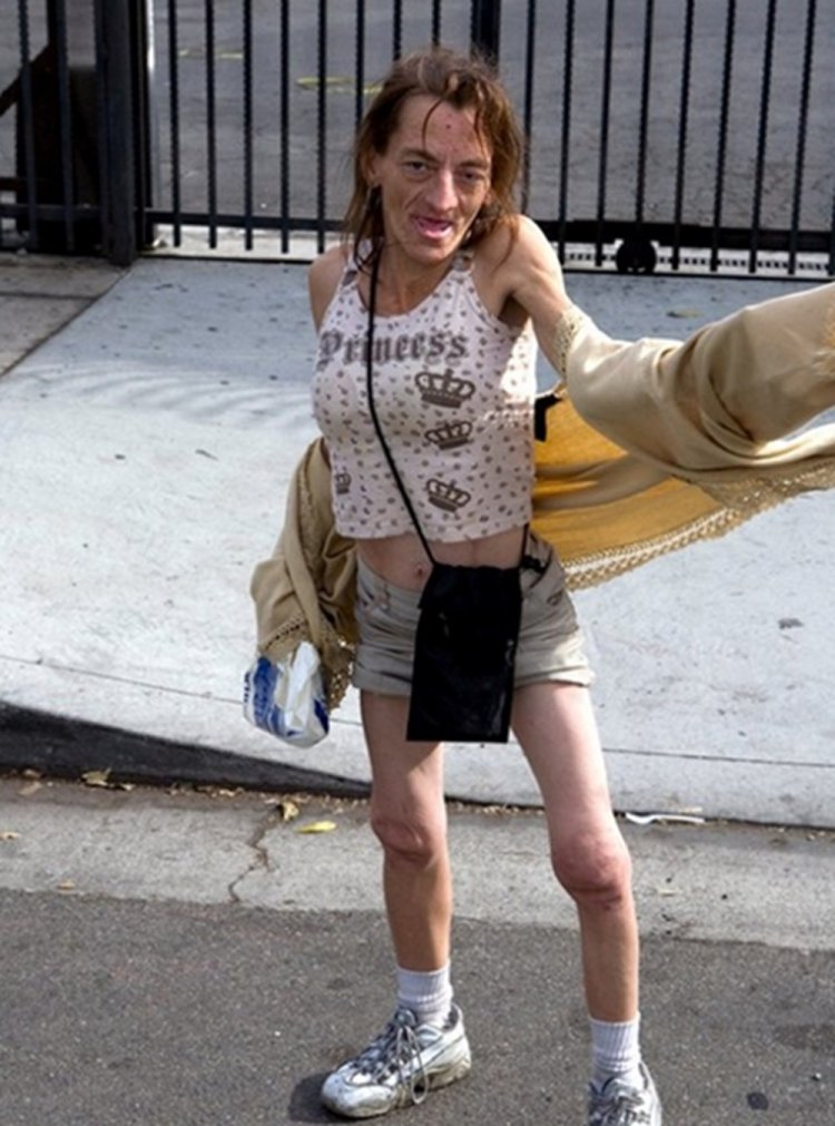 Russian ugly homeless girl nude and Russian ugly homeless