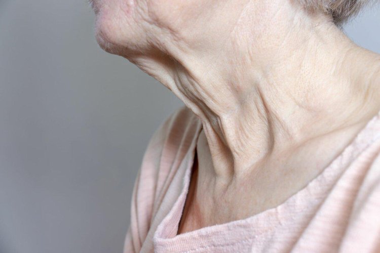 The neck of an elderly woman