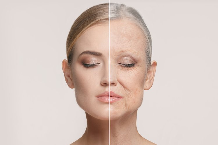 Skin aging