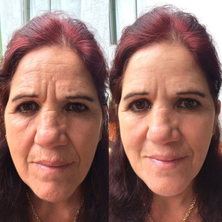 Facebook building before and after