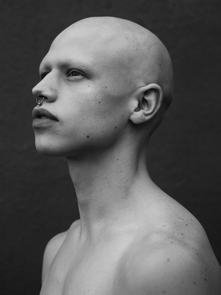 Incel bald edward