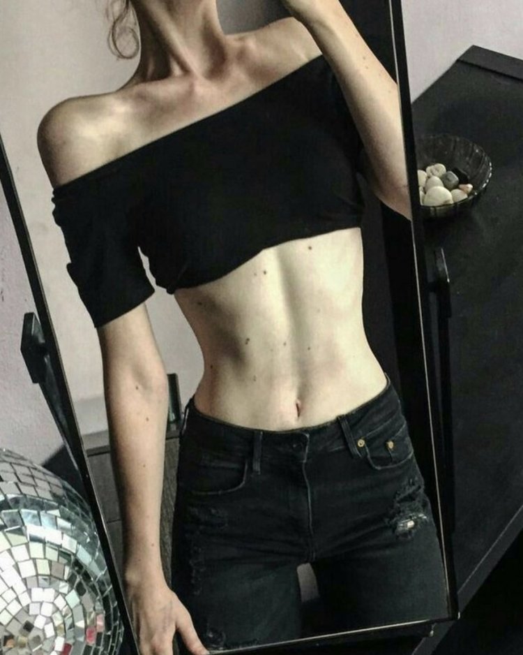 Anorexic bone motivation
