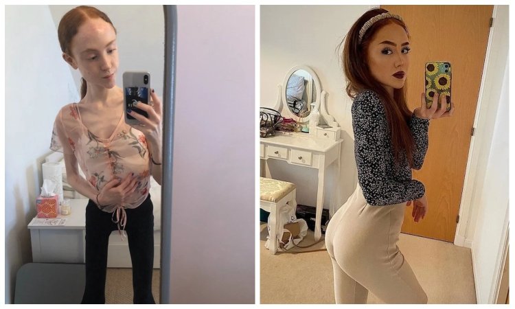 Ellie Spoffort anorexia