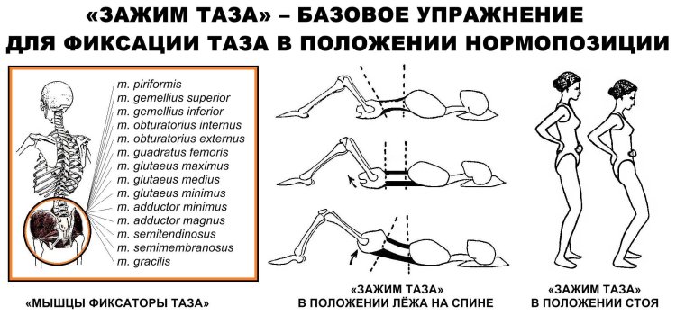 Exercises for the correct position of the pelvis