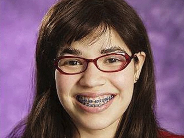 Ugly Betty Teeth
