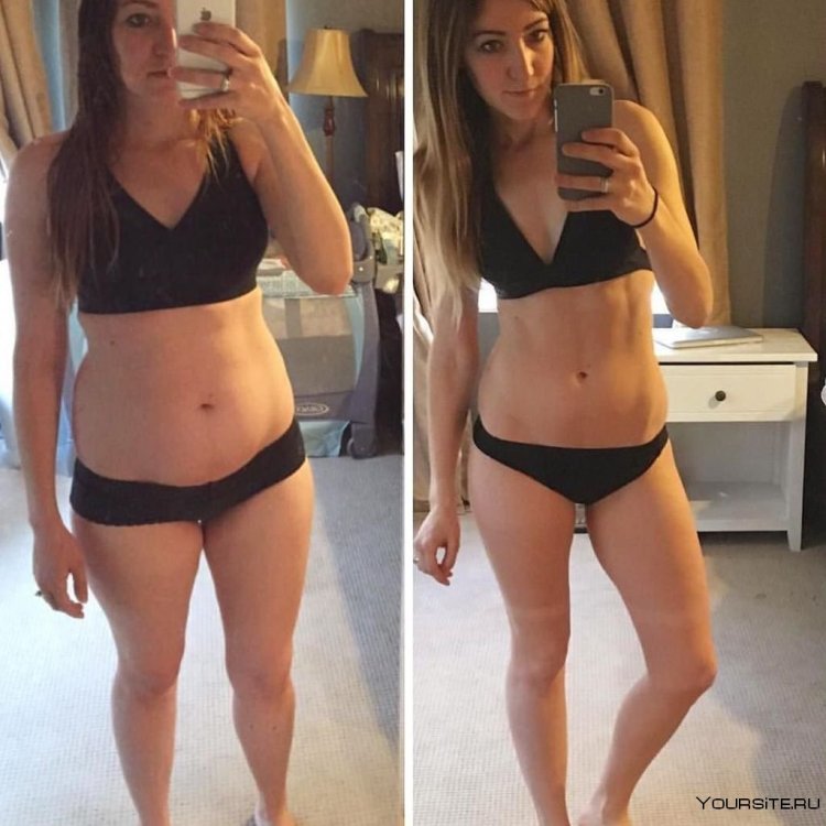 Before and after weight loss girl