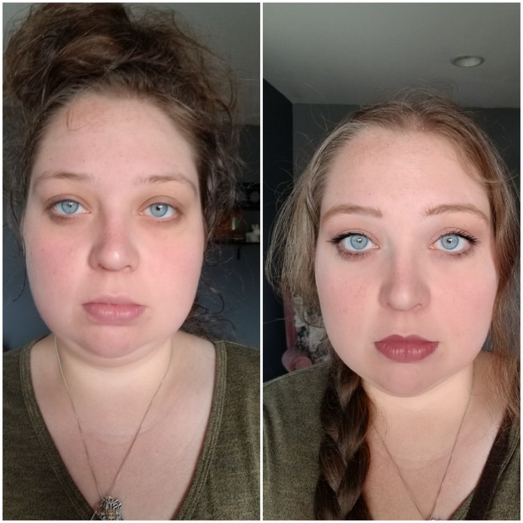 Change in appearance after taking estrogen
