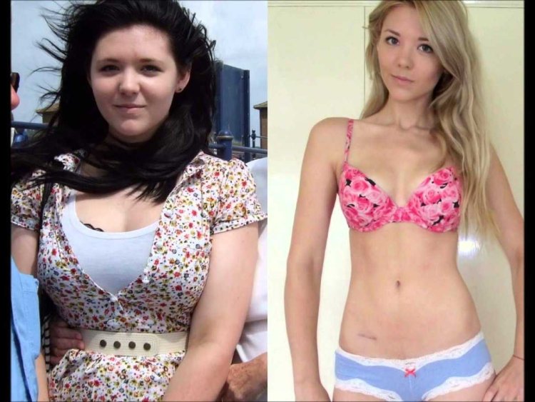 Young girls before and after losing weight