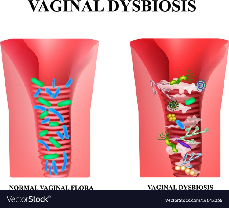 The bacterial flora of the vagina