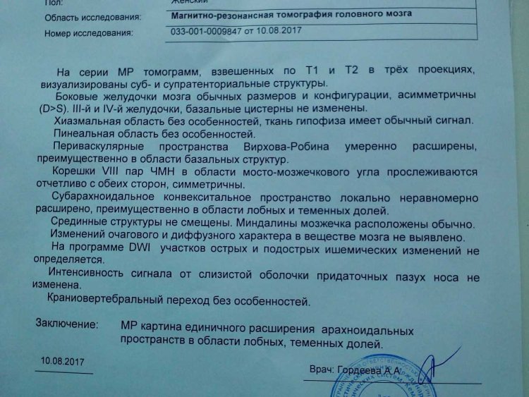 Computed tomography of the brain conclusion