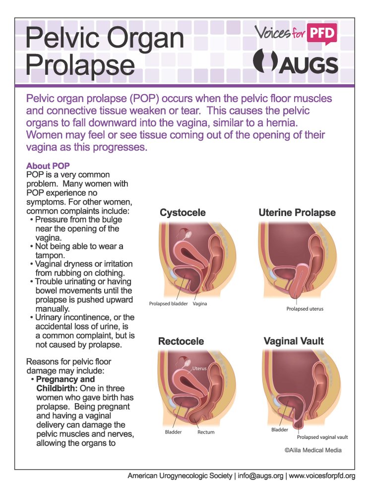 Vaginal prolapse from below