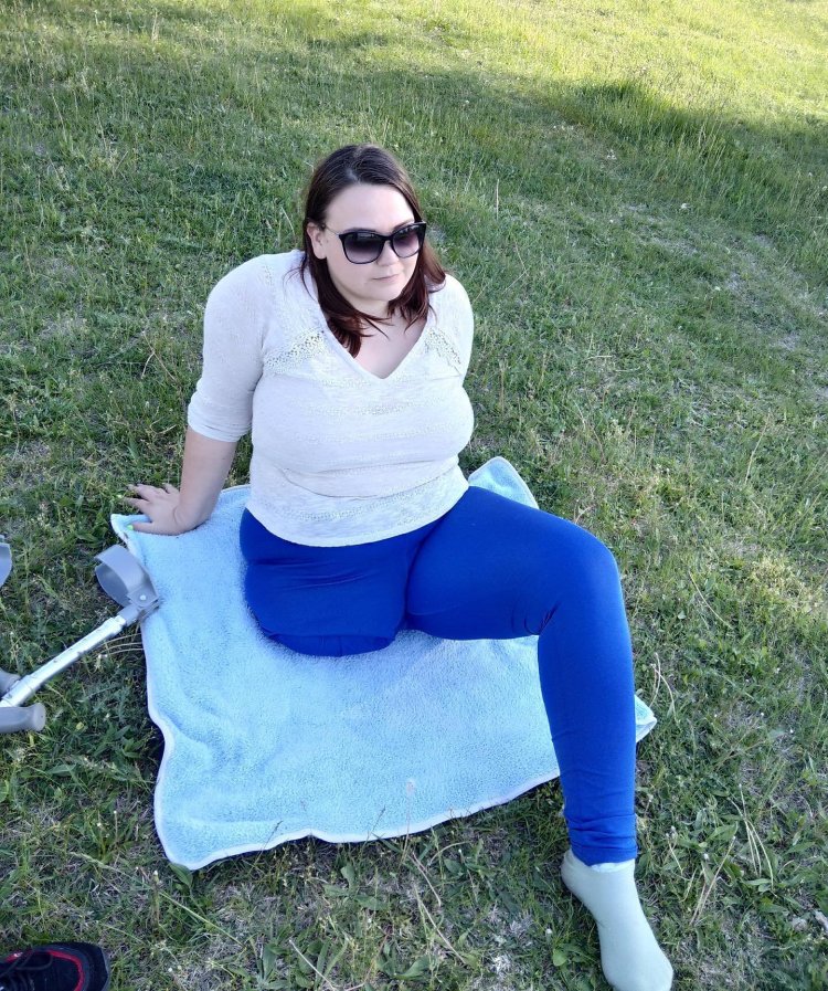 Amputee Barbara Fernandez