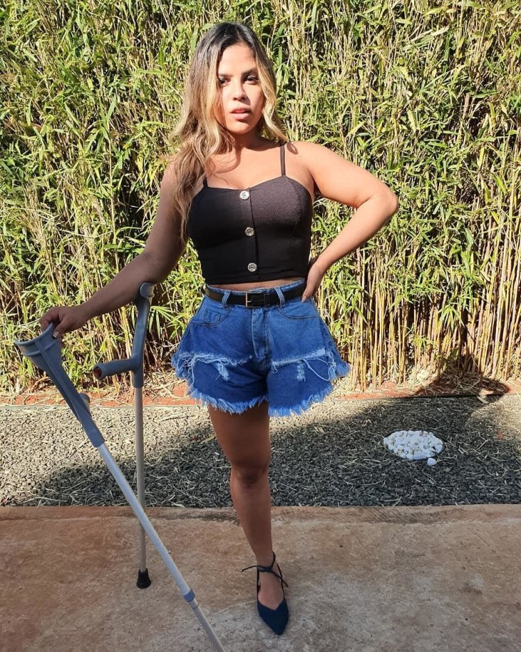 Natasha Vinogradova amputee