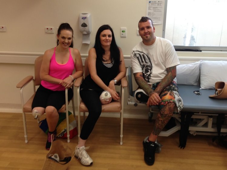 Amputee is one-legged and without an arm