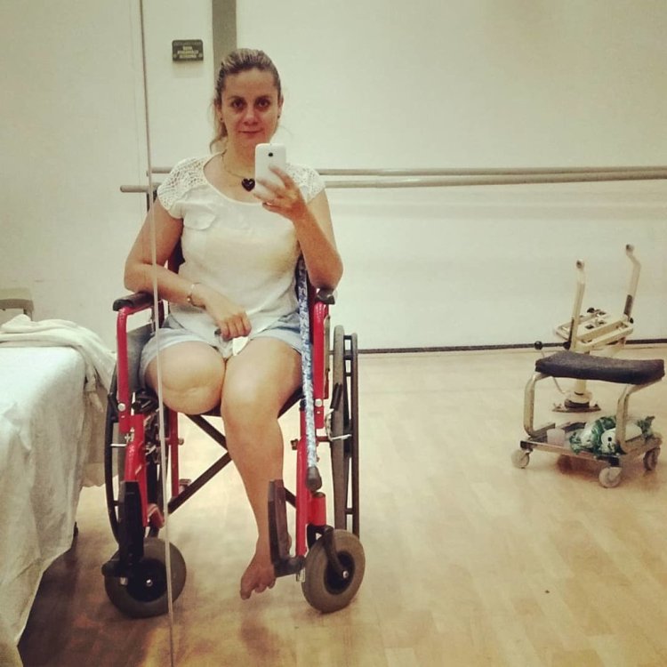 Amputee Petrunina Elena