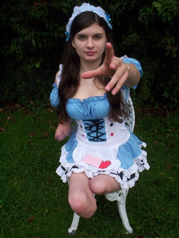 Quad amputee cute girl