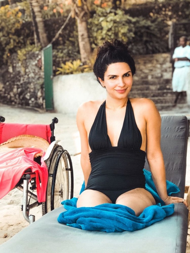 Amputee brazilian women