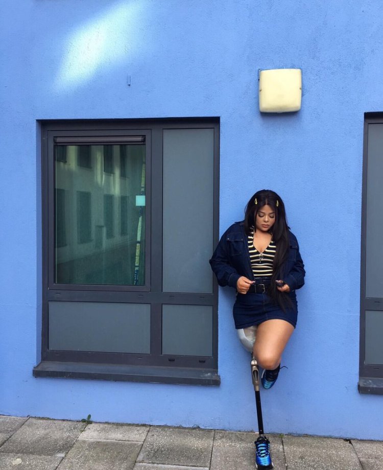 Amputee from instagram