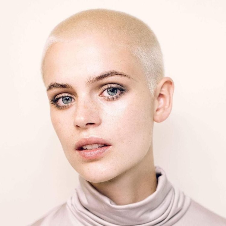 Natasha Whiteman is bald