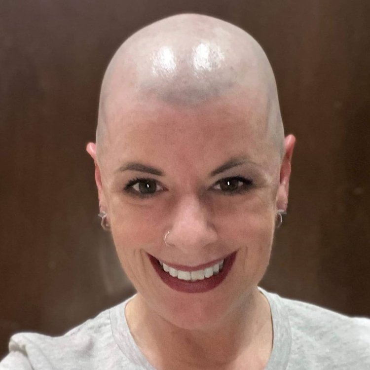 Mia Boyko is bald