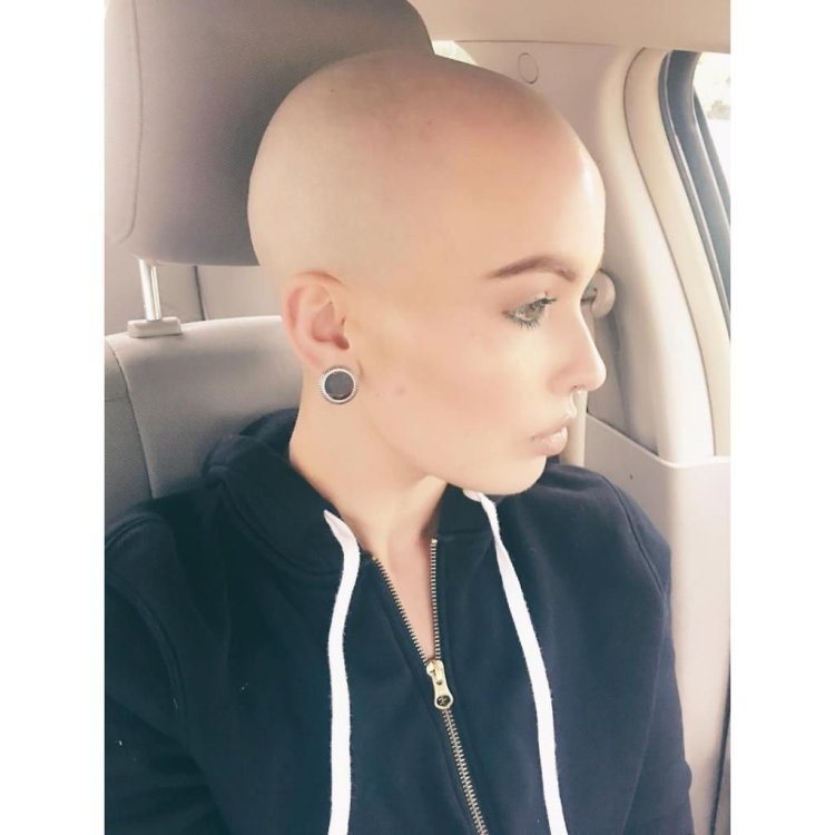 Bald girl in the hospital