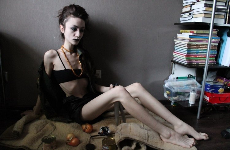Chiara schober shober anorexia