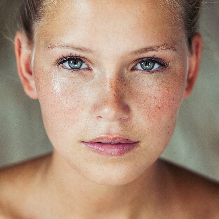 Blonde hair and freckles