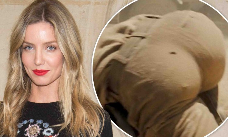 Annabelle Wallis before and after rhinoplasty