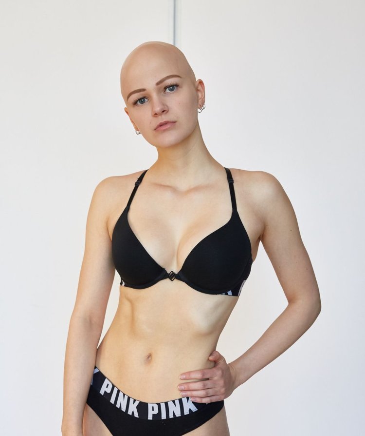 Katya Sheleg bald