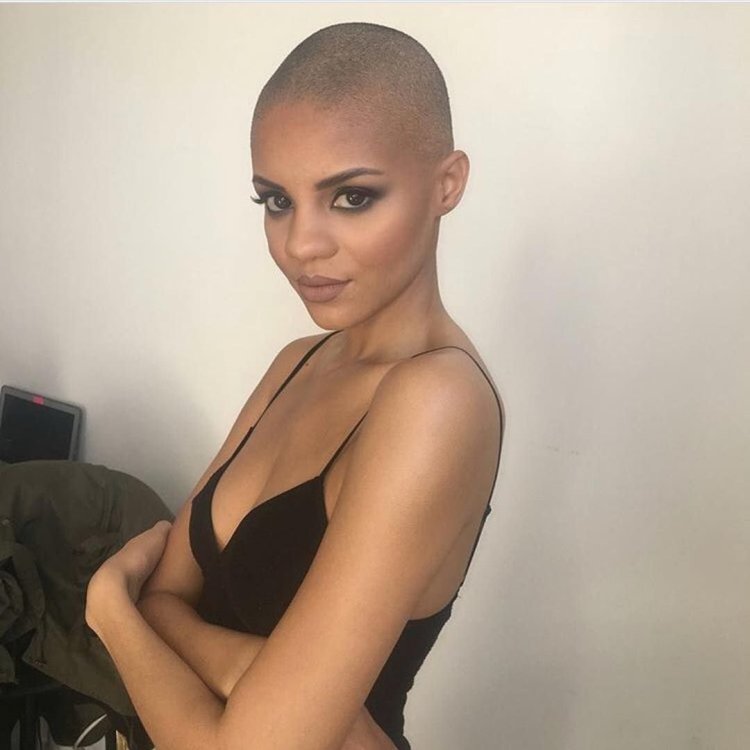 Natasha Whiteman is bald