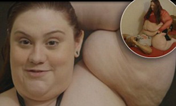 Obesity 4 degrees in women