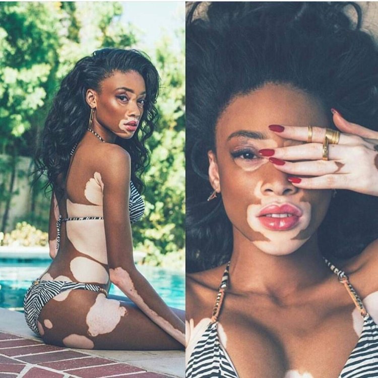 Winnie harlow model