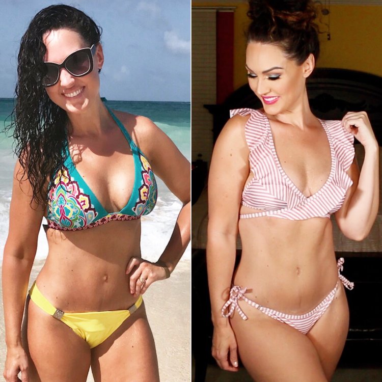 Beautiful breasts with implants