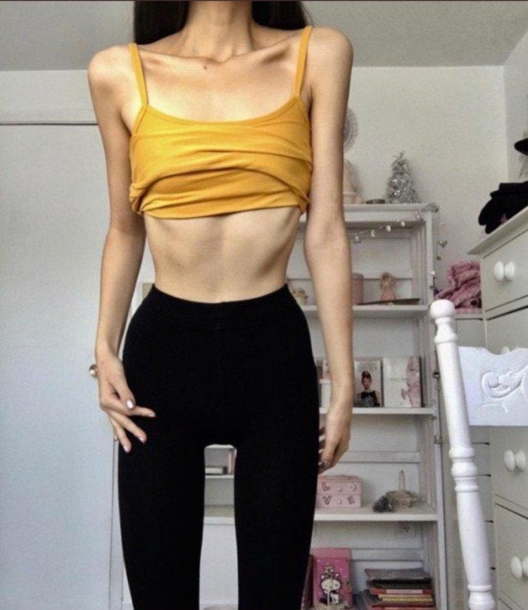 Beautiful anorexia