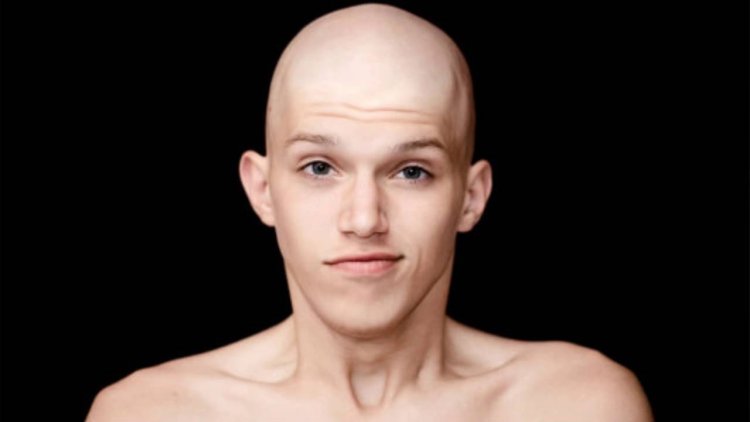 Bald man