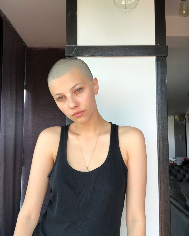 Bald teen girl