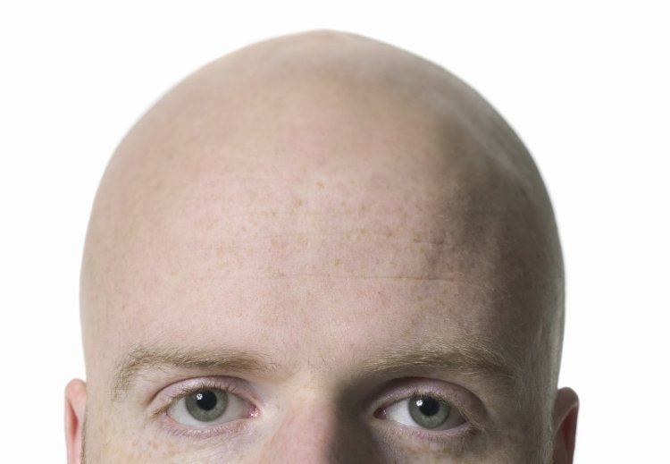 Bald heads of men