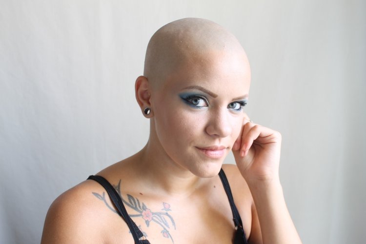 Natasha Whiteman is bald