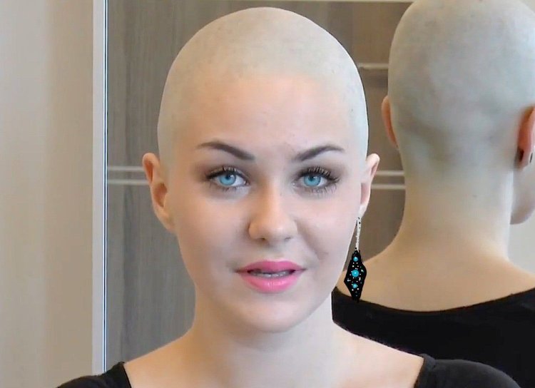 Kerry Wellis is bald