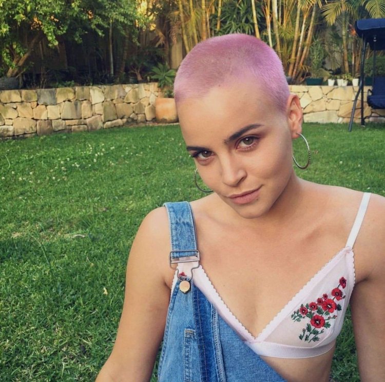 Natasha Whiteman is bald